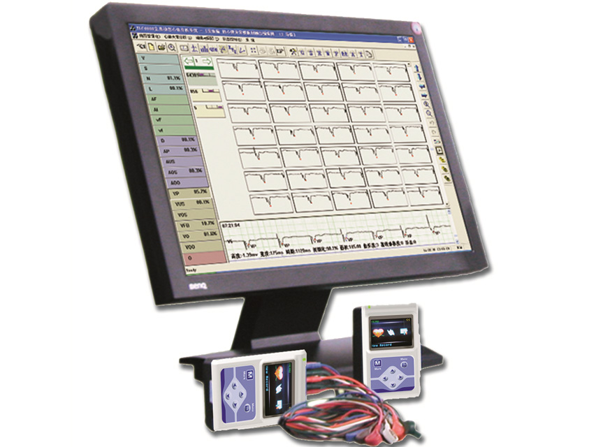 Risultati Holter ecg