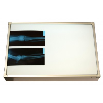 Negativoscopio diafanoscopio 70x42 cm - orizzontale - acciaio inox