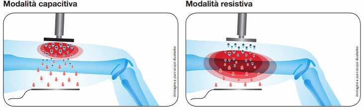 \itech-ar-modalita